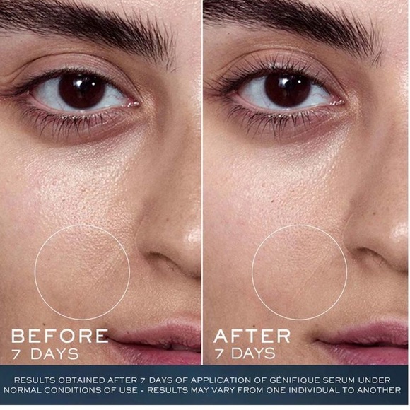 LANCOME ADVANCED GÉNIFIQUE
STRENGTHEN & REPAIR 3-STEP ROUTINE (A 220 VALUE) - Picture 3 of 6